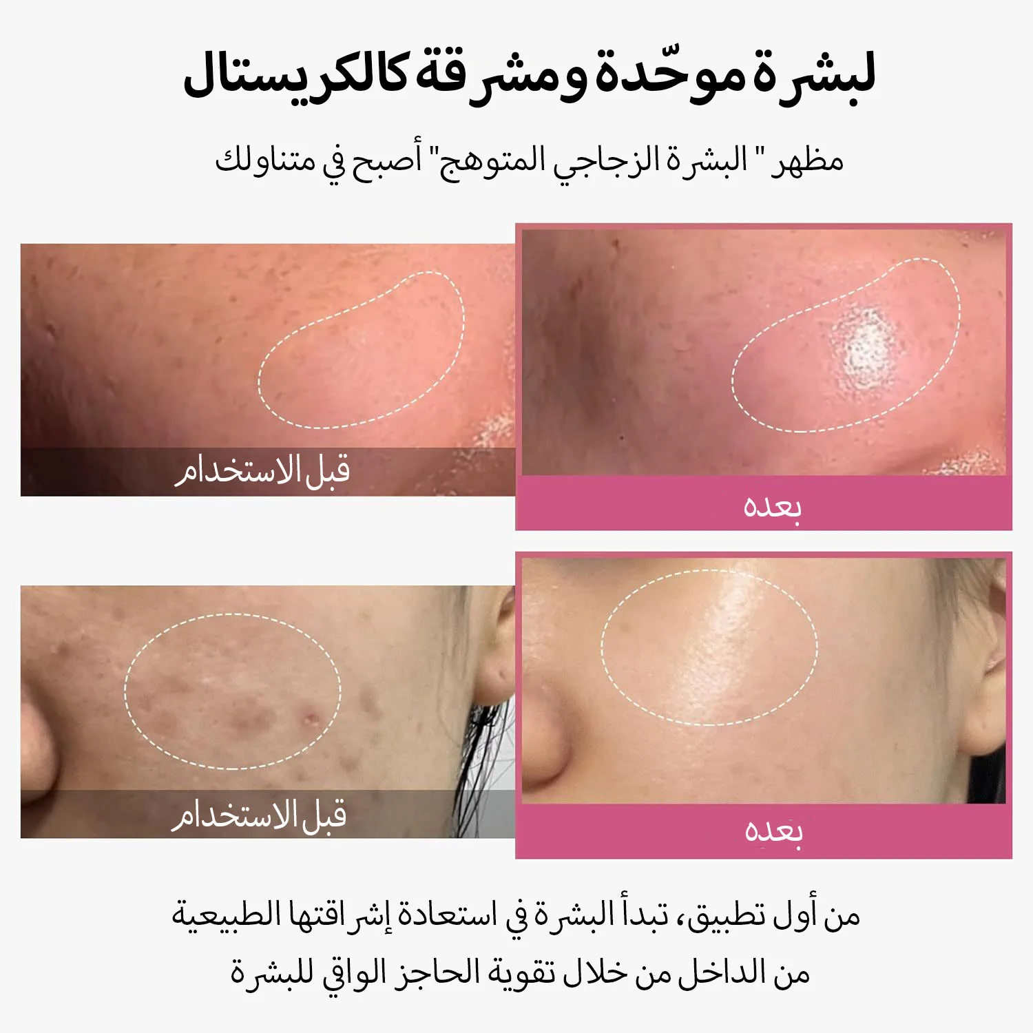 MEDICUBE - AGE-R Booster Pro Pink - Appareil de soin visage