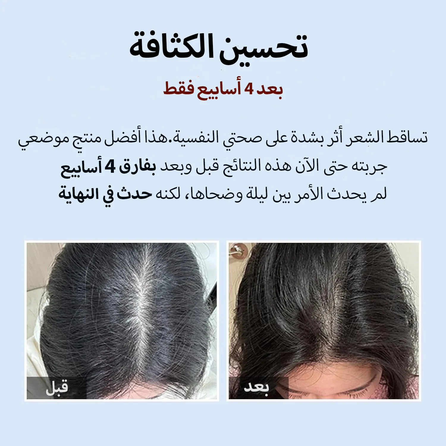 المنتج الأول في كوريا لعلاج تساقط الشعر وفروة الرأس
