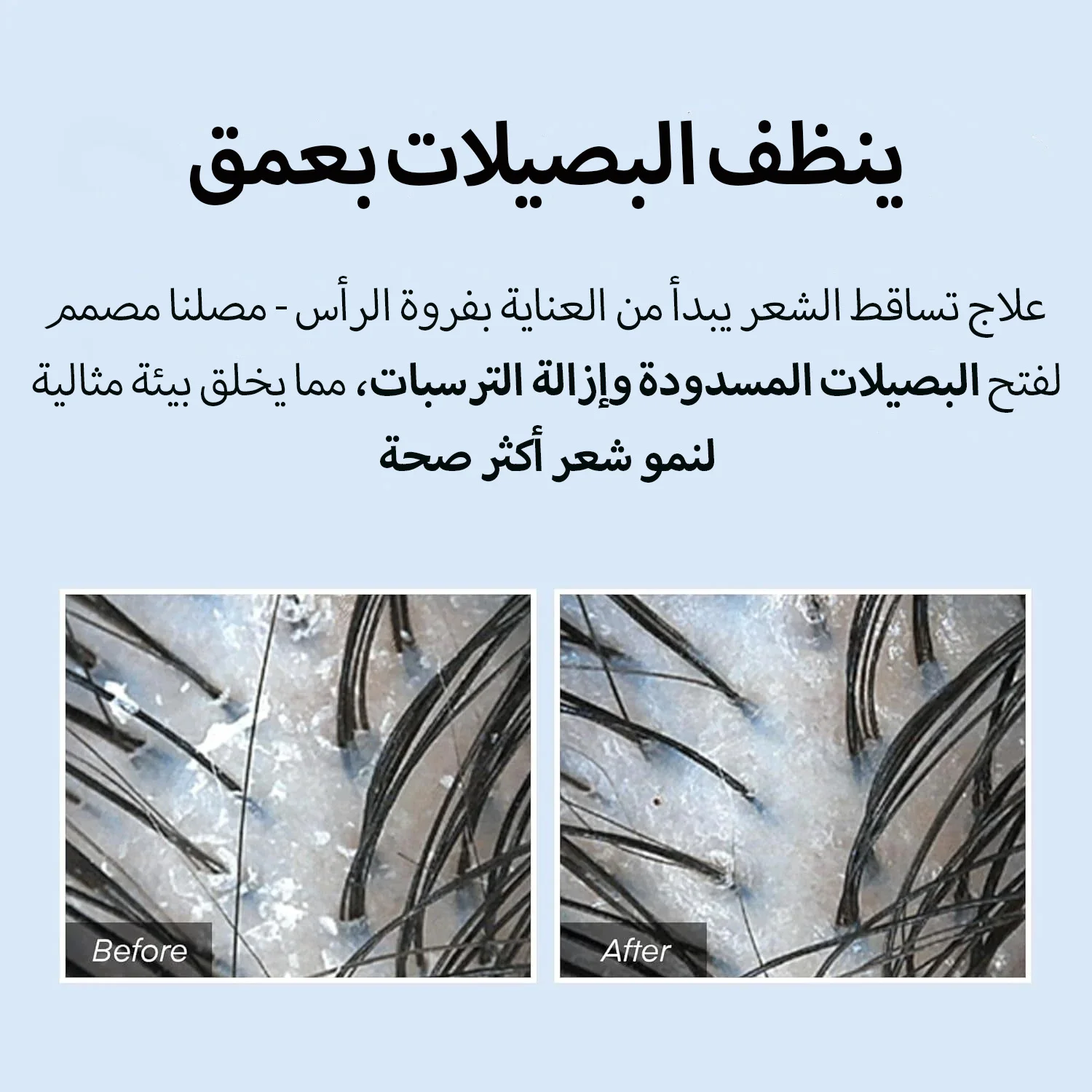 المنتج الأول في كوريا لعلاج تساقط الشعر وفروة الرأس