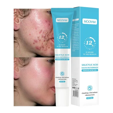 Gel efficace pour les boutons et anti-acné rapide  pour le visage à base de plantes (Pack de 2 gels). Pour tous types de peau.