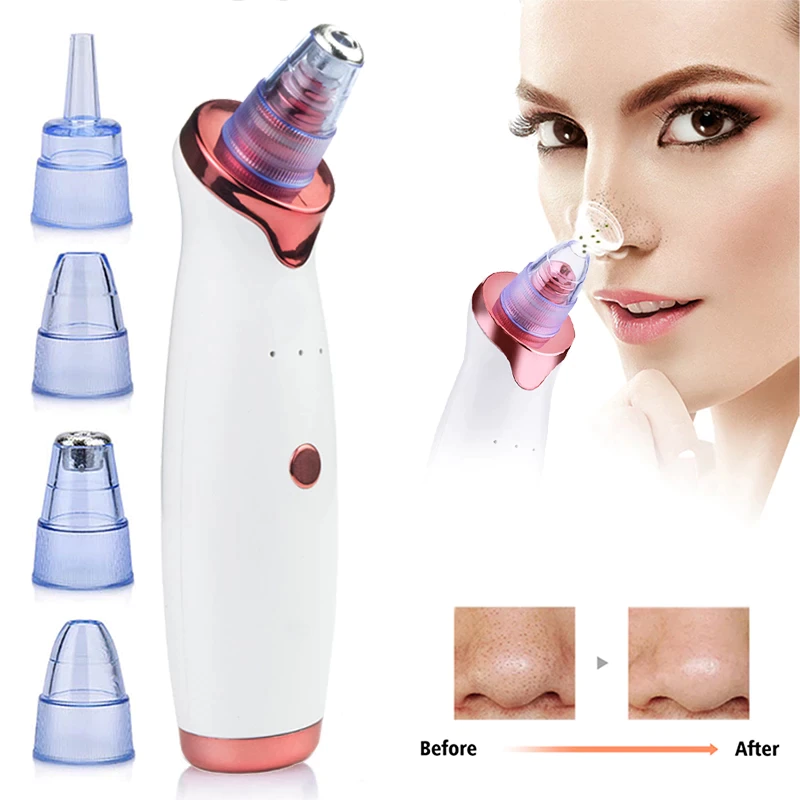 Nettoyeur électrique de points noirs pour visage, nettoyeur d'acné, aspirateur de points noirs