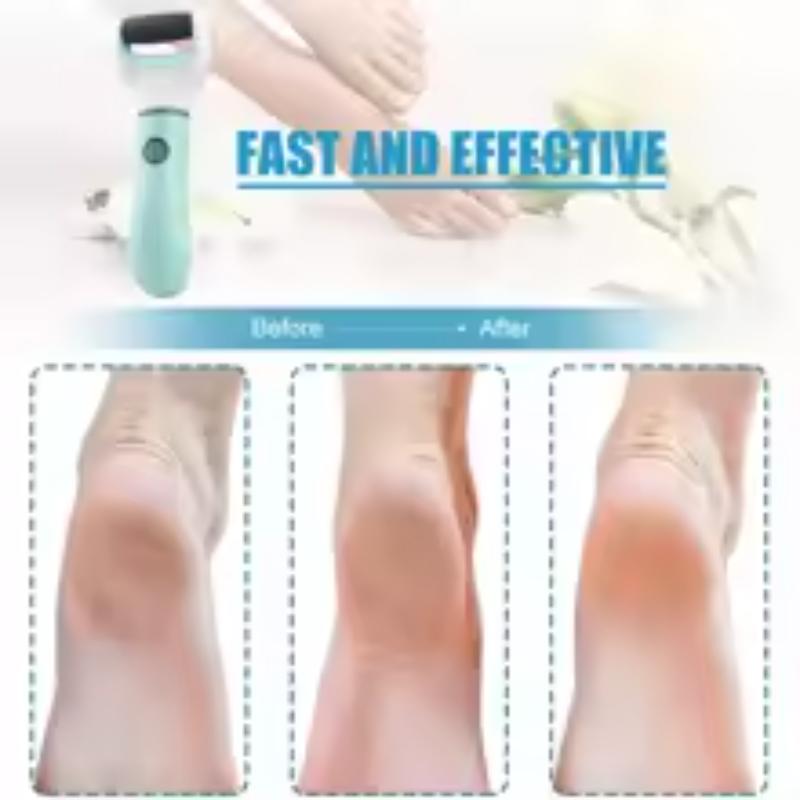 SmoothSole™ Electric Pedicure Grinder – Callus & Dead Skin Remover