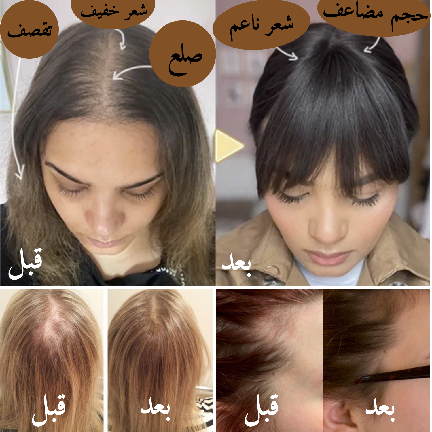 شامبو الزنجبيل الطبيعي لنمو وكثافة الشعر