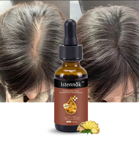 زيت الروزماري لعلاج تساقط الشعر