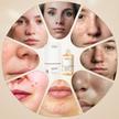 stores/d5f224bc65df4dc9ce93aae7d49ecdb4/products/auC2iBEihLQFq7W2RD4XWUhUQFfsBDGFPD300D6a.jpg