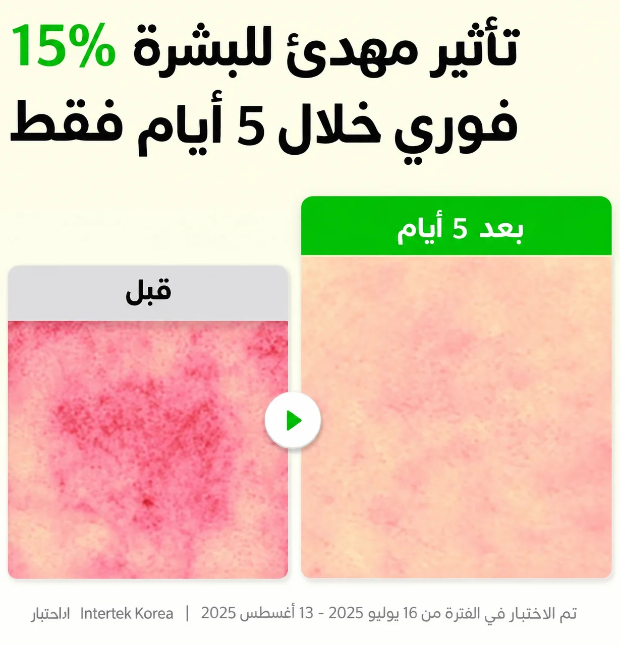 سيروم إكوالبيري بالألوفيرا وPDRN لتهدئة وتنعيم البشرة – 30 ملEQQUALBERRY Aloe PDRN Calming Smoothie Serum 30 ml