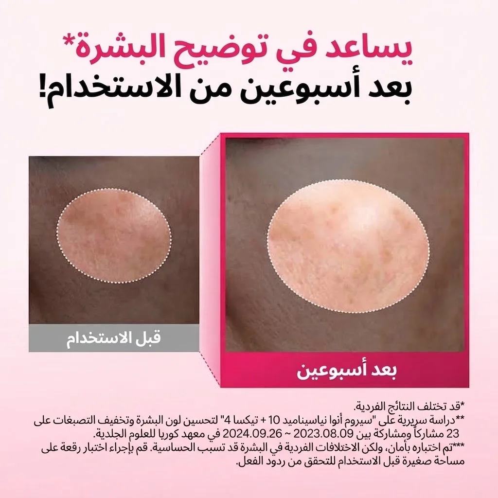 سيروم نياسيناميد ١٠ وحمض الترانيكساميك ٤ لتفتيح البشرة وإزالة البقع الداكنةNiacinamide 10 TXA 4 Serum for Brightening and Dark Spots