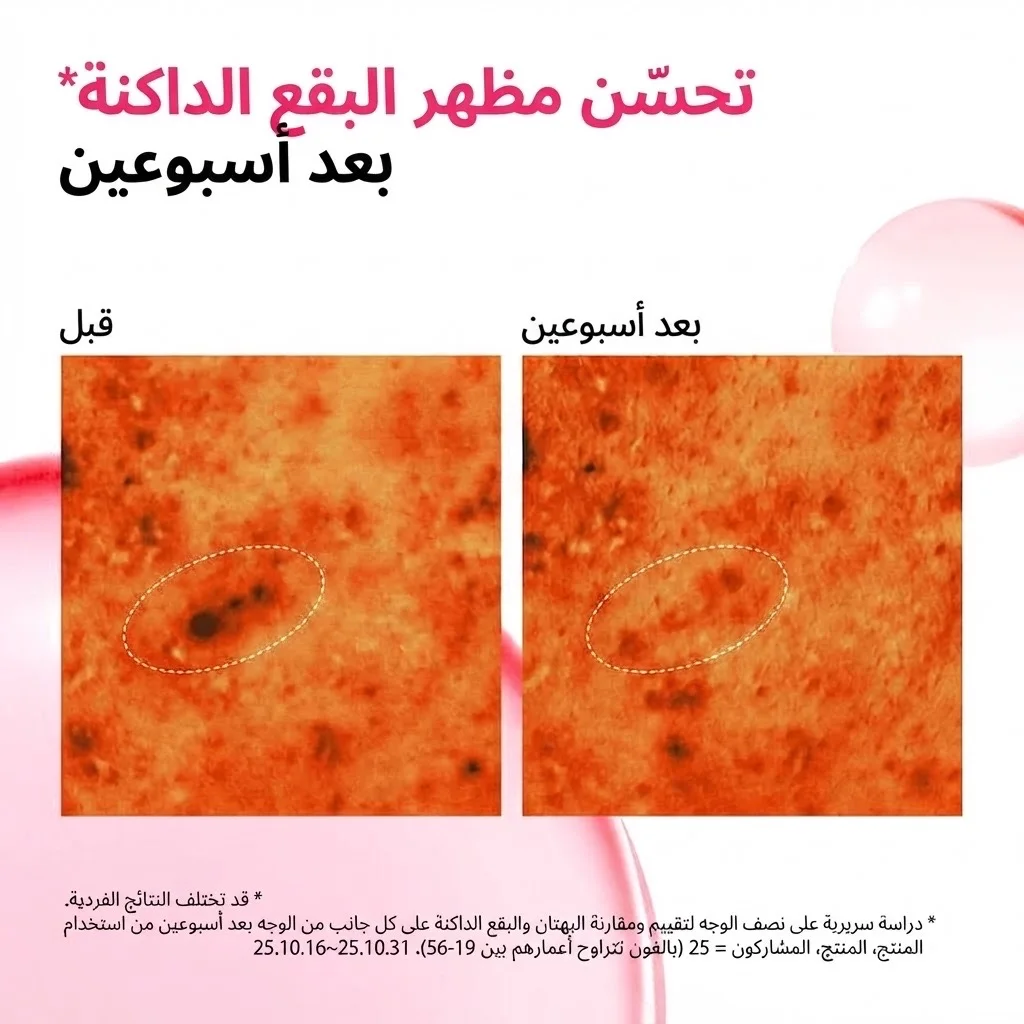 تونر معزز لتفتيح البشرة بحمض النياسيناميد والترانيكساميك Niacinamide Tranexamic Acid Brightening Booster Toner