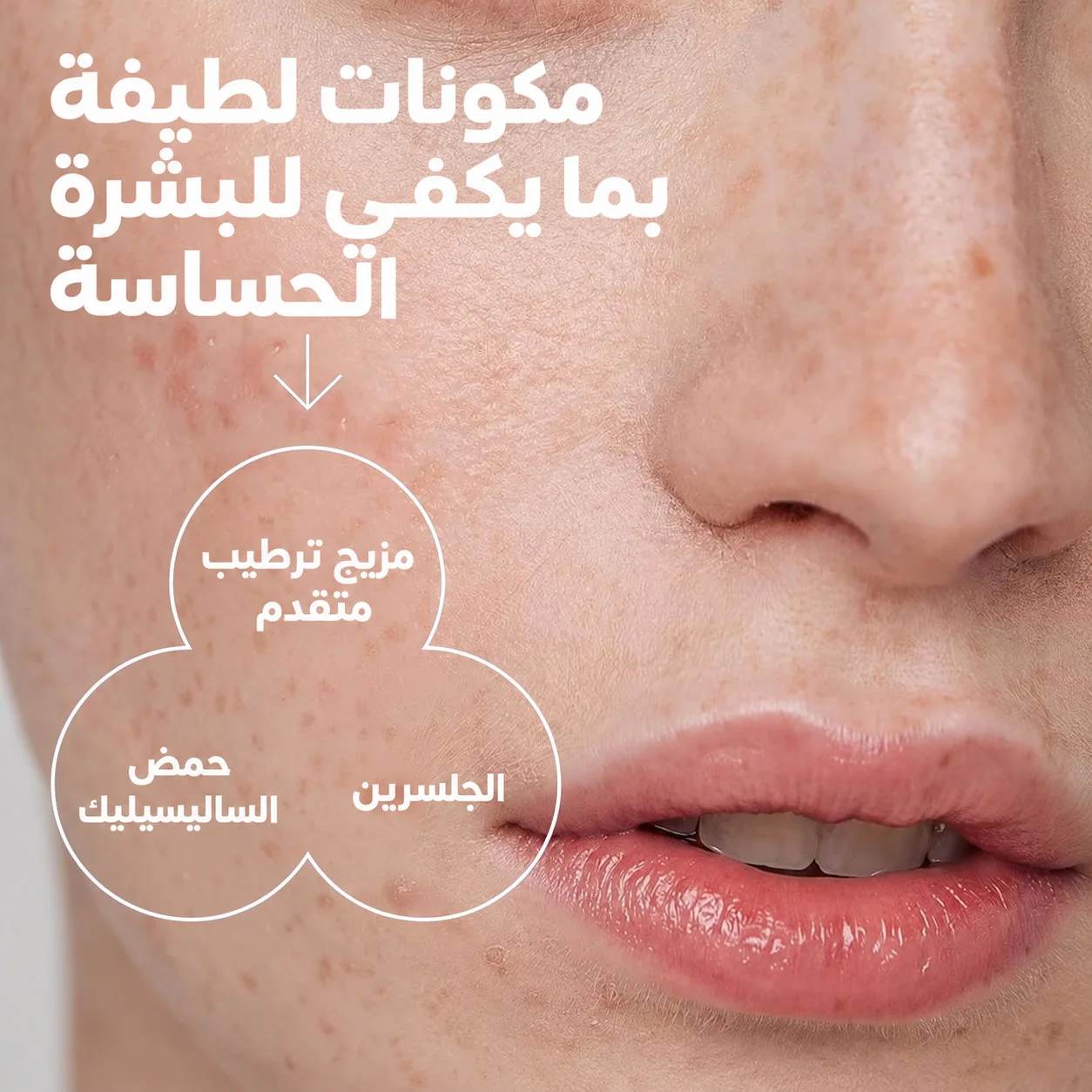 غسول الوجه الرغوي اللطيف من سيتافيل لعلاج حب الشباب، ٢٪ حمض الساليسيليك 236ملCetaphil Gentle Clear Pore Clearing Acne Cleanser with 2% Salicylic Acid