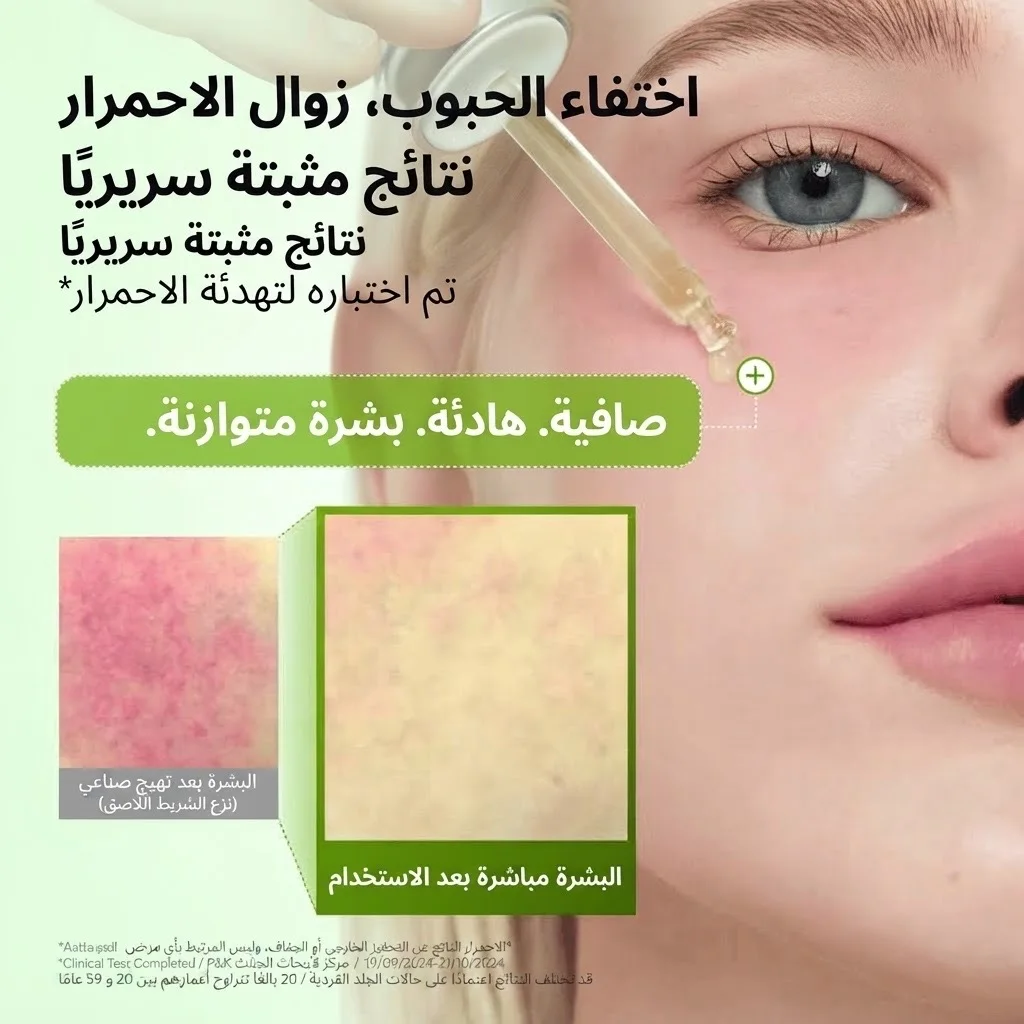 سيروم مهدئ للاحمرار يحتوي على حمض الأزيليك و10% من حمض الهيالورونيك Azelaic Acid 10 Hyaluron Redness Soothing Serum