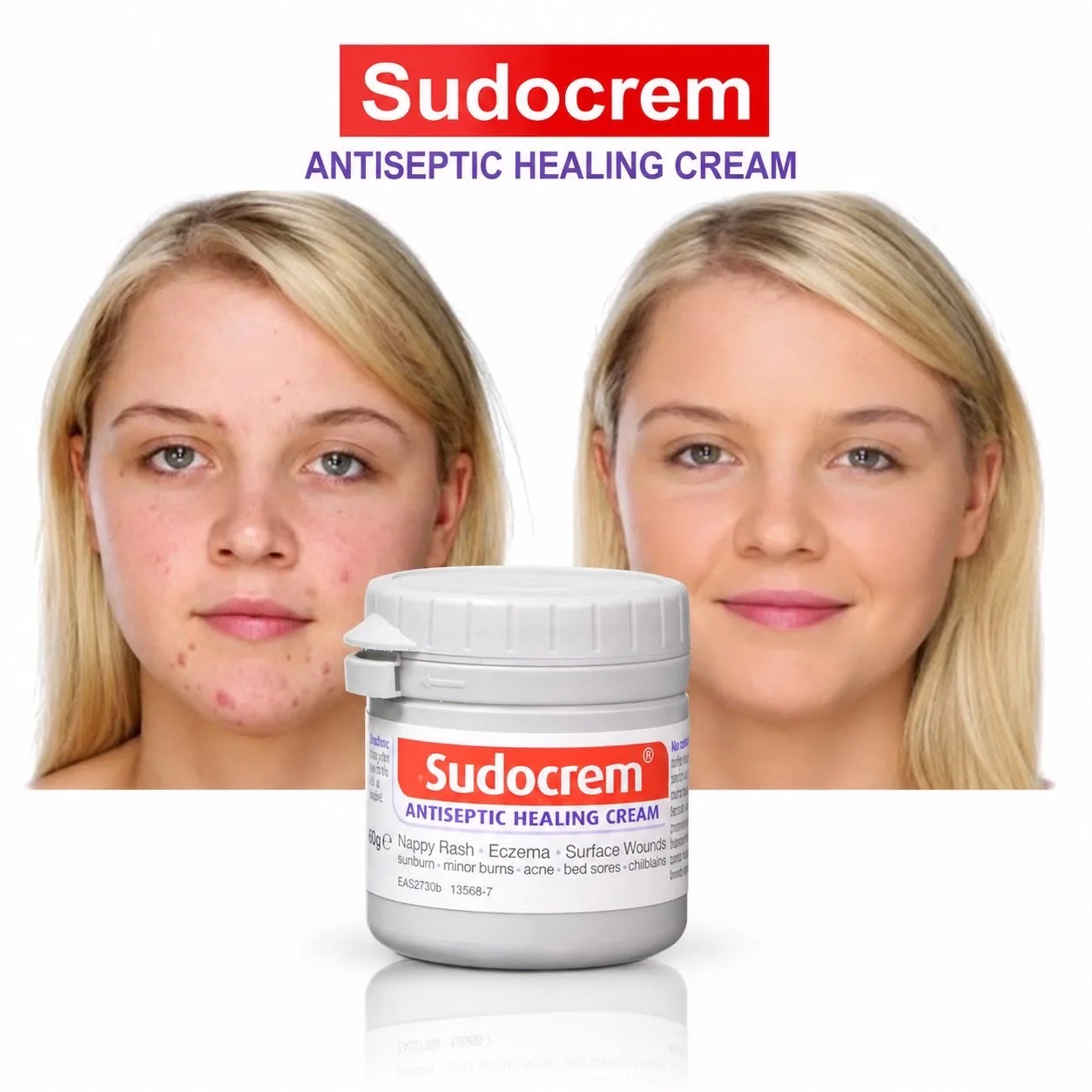 SudoCream 60g, 125g صودو كريم لعلاج طفح الحفاضات و التحسس بالجلد
