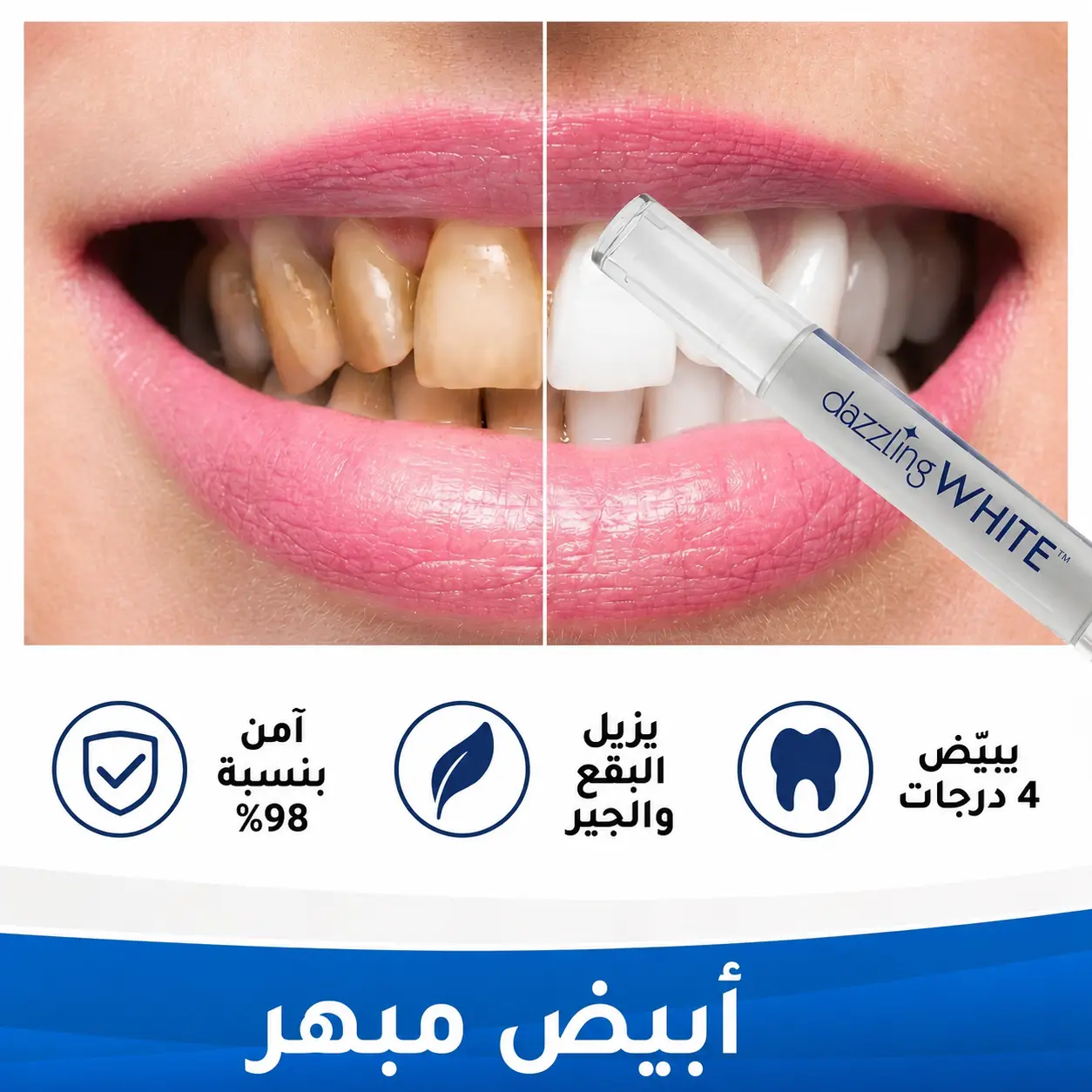 قلم تبييض الاسنان