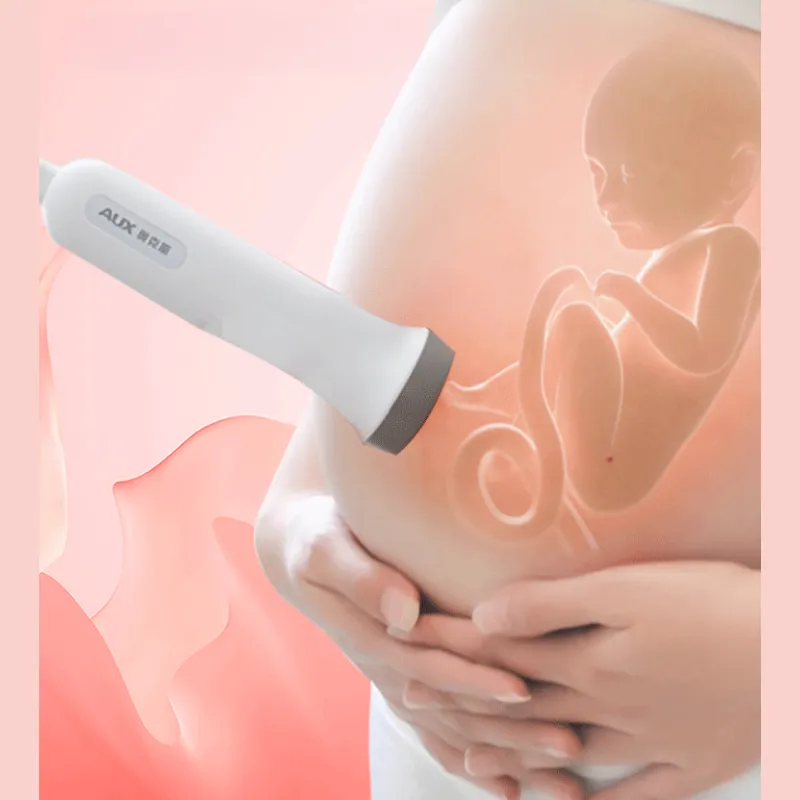 Si vous souhaitez surveiller votre bébé dans le ventre de votre femme, vous êtes au bon endroit