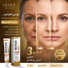 بوتوكس كريم بخلاصة سم النحل