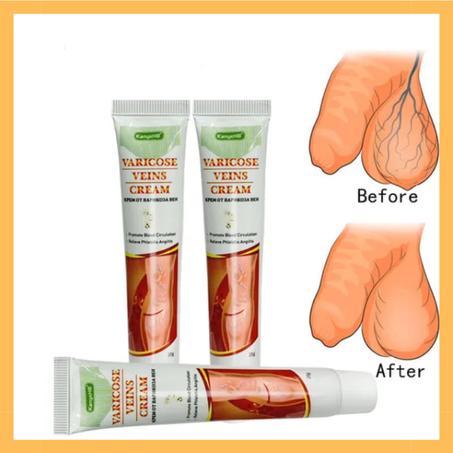 crèmes pour varices génitales