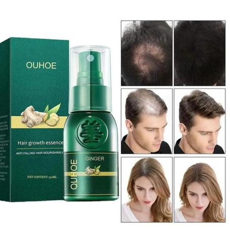 Offre Spéciale repousse personnalisée 7 jours gingembre germinal croissance des cheveux sérum gingembre huile essentielle croissance des cheveux sérum spray