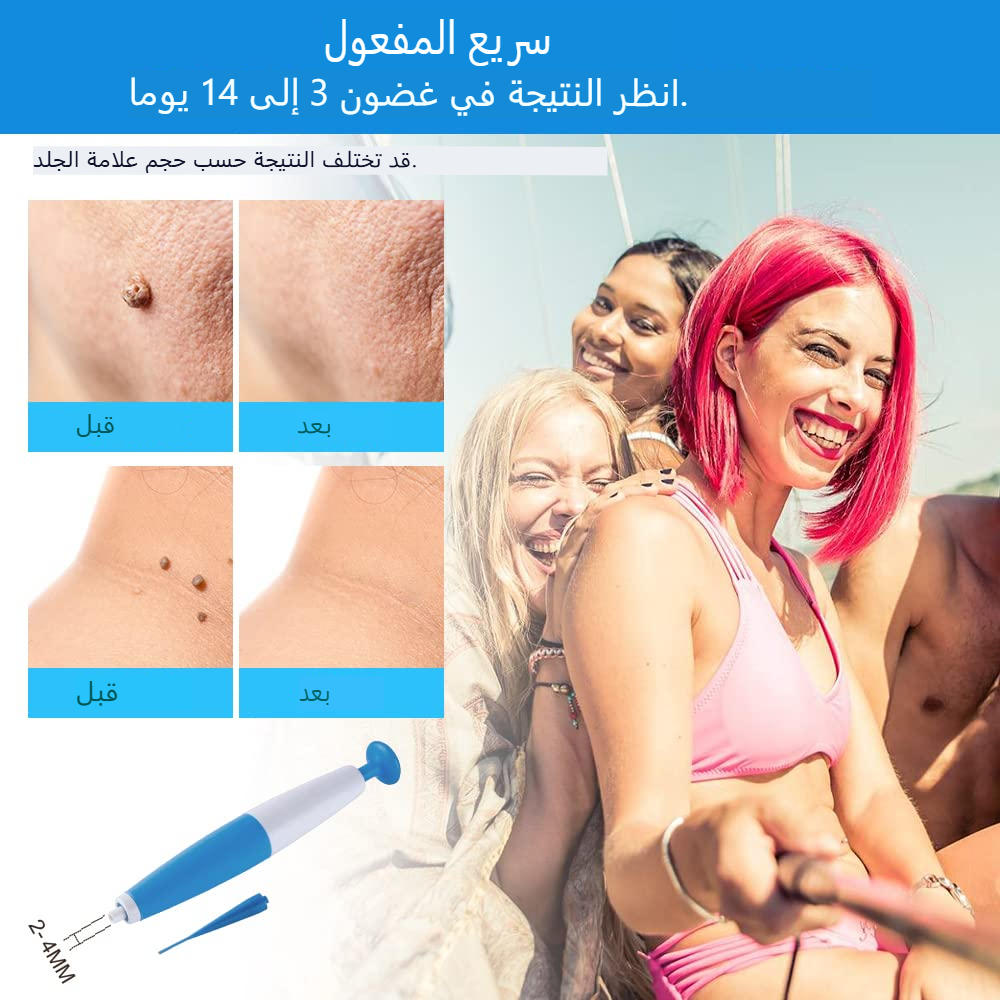 أداة لإِزالة الثأليل + كريم سكورا الياباني