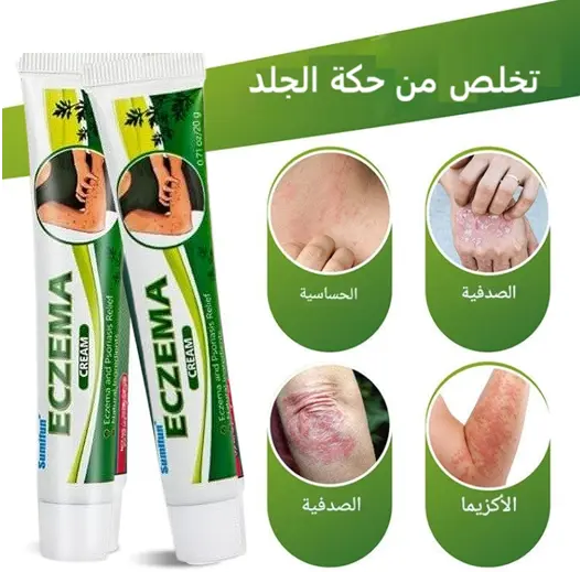 كْرِيمْ سوميفن لِعلاج الإِكزيما