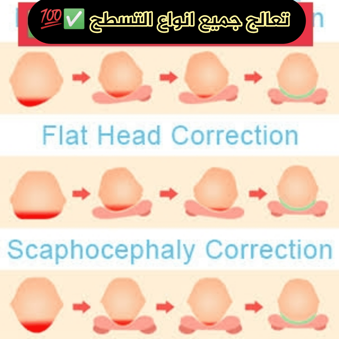 stores/d80050d00e5a37723f2e1d4106e3abf9/products/6F2H9Tdegby4KYbXEET3Q7YGHKRxgnEvBneUYckC.png