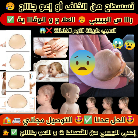 االوسادة الطبية لتسسطح و إعوجااج الرااس البيبي علا ج + و قاية