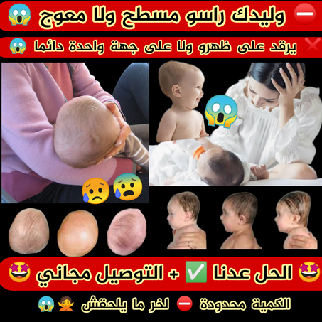 االوسادة الطبية لتسسطح و إعوجااج الرااس البيبي علا ج + و قاية
