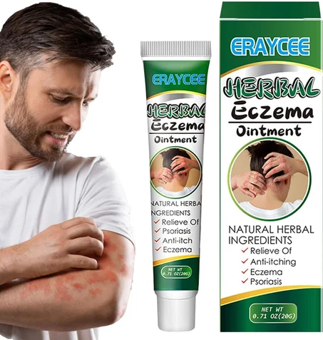 Herbal Ointment For Eczema
