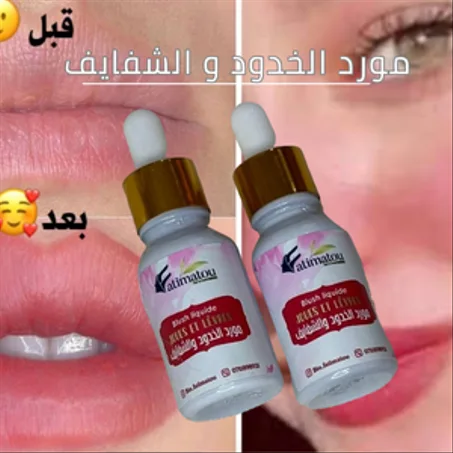 مورد الخدود والشفايف