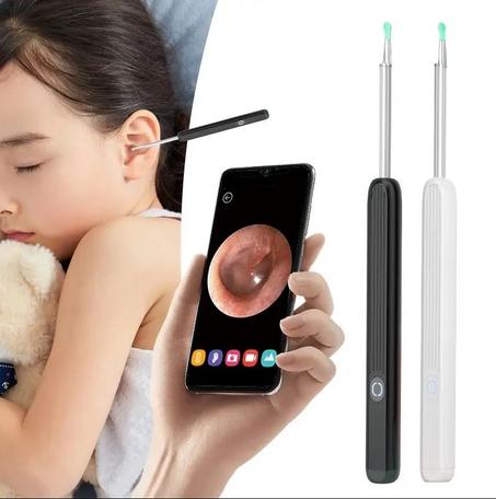 منظار الأذن اللاسلكي  تنظيف آمن وفعال للأذن