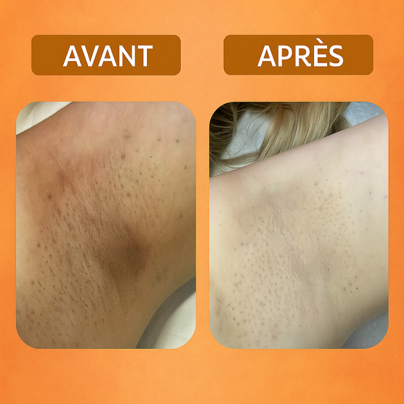 PAPAYA 2 = 3éme Gratuit