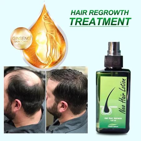 Neo Hair – Lotion Verte De Thaïlande, Spray D'huile Pour La Croissance Des Cheveux