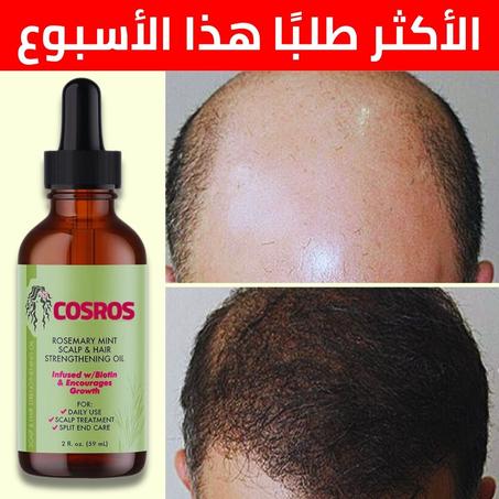زيت إكليل الجبل COSROS للتخلص من الصلع وتساقط الشعر