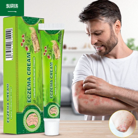 كريم الأكزيما