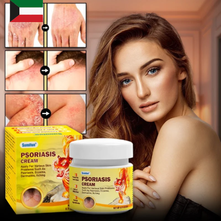 كريم علاج الصدفية والإكزيما