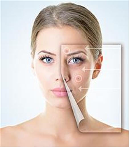 Soins Anti-Imperfections