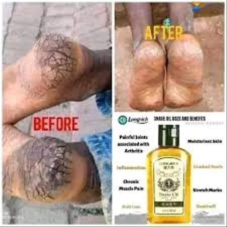 HUILE DE SERPENT LONGRICH