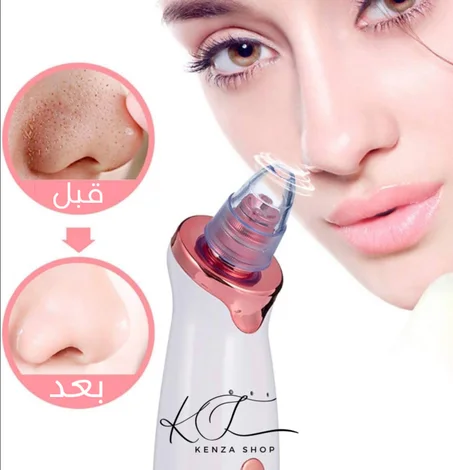 مزيل النقط السوداء