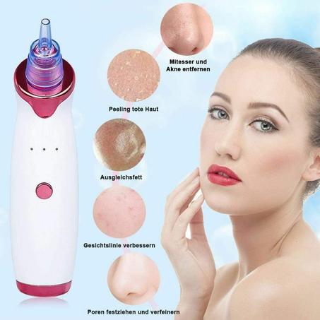 الة الرؤوس السوداء