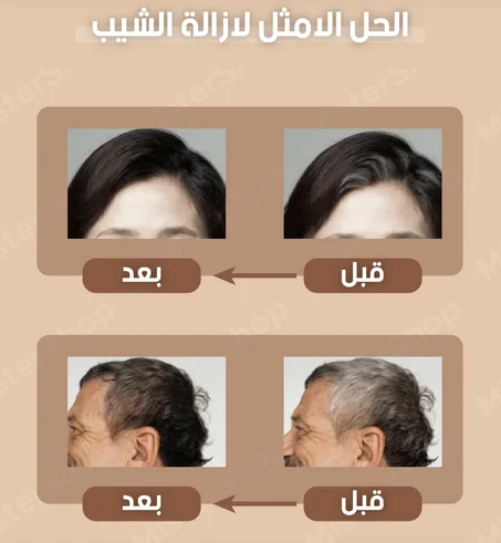 القلم الاسفنجي لملء فراغات الشعر