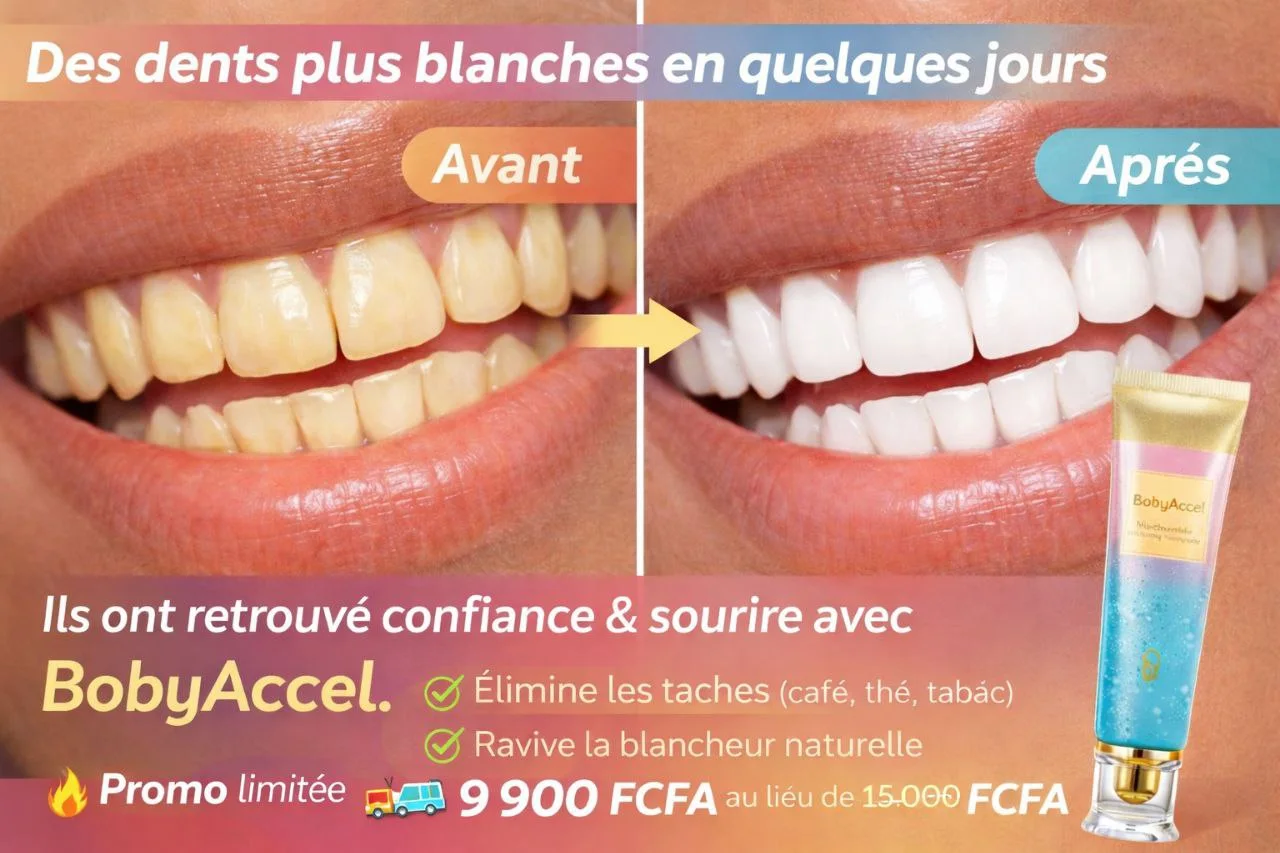 👉 Dentifrice Blanchissant à la Niacinamide – Anti-Taches & Haleine Fraîche