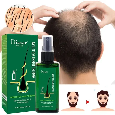 ✨🔥بخاخ مضاد لتساقط الشعر للجنسين الرجال و النساء  لإعادة نمو الشعر، علاج عشبي طبيعي 🔥💖