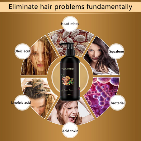 شامبو للشعر الأسود