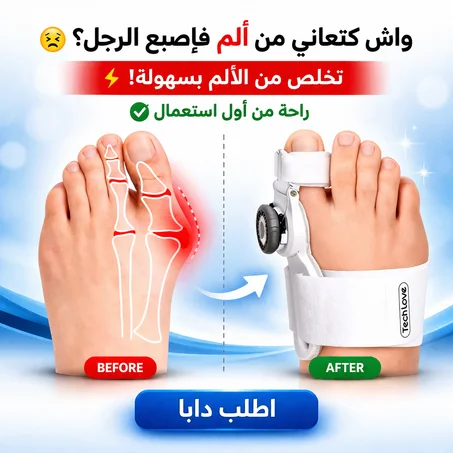 واش كتعاني من ألم فإصبع الرجل؟ 😖