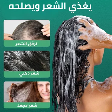 وداعاً لتساقط الشعر