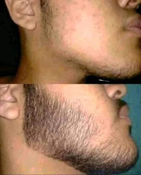 زيت أوميغا لكثافة اللحية وتعبئة الفراغات