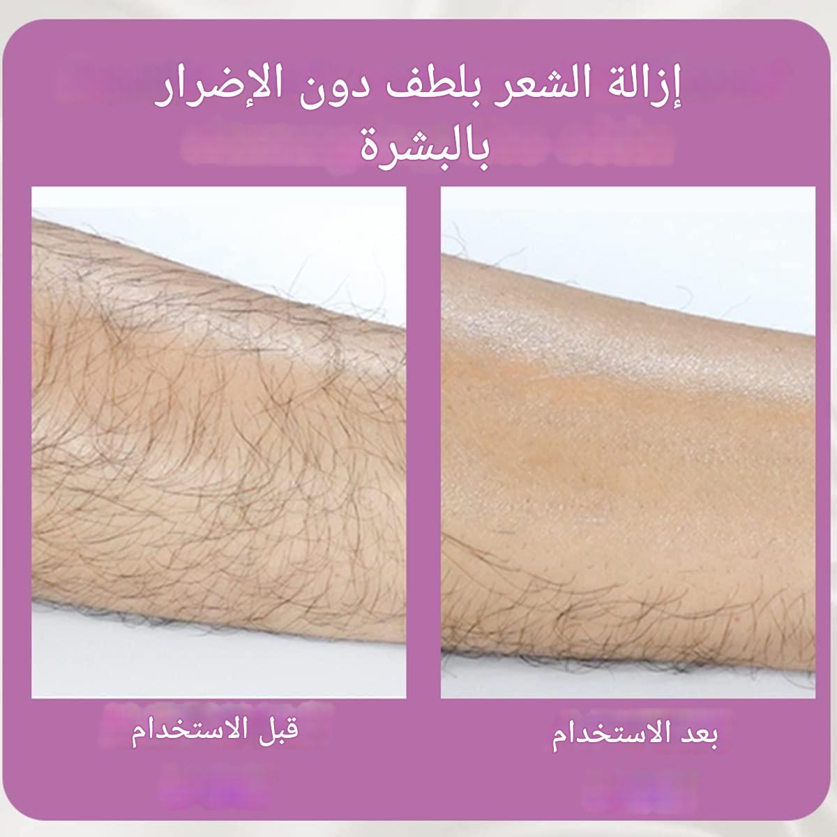 Crystal Hair Removal