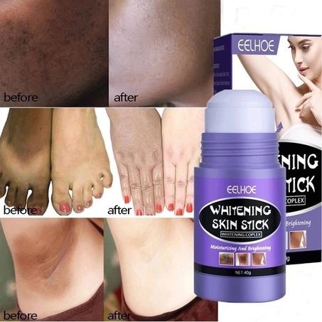 كريم التبييض – ARMPIT WHITENING CREAM