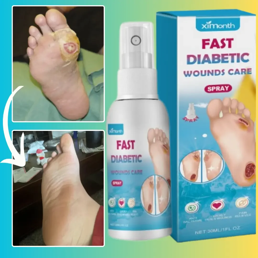 Spray Ximonth para sanar heridas de diabéticos