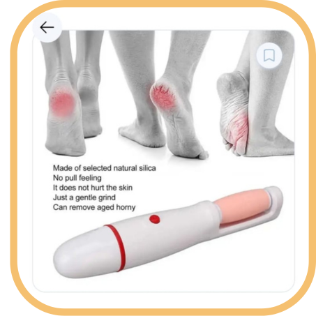 مقشر الجلد الميت