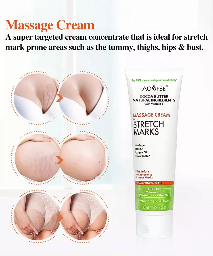 علاج علامات التمدد