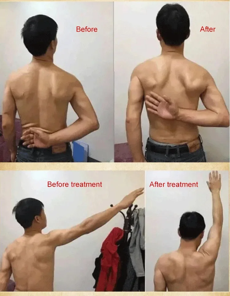 Shoulder Spray Pain Relief -KSA